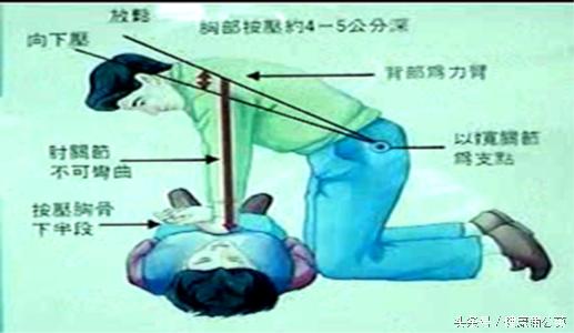 探究最新版2020心肺复苏指南，守护生命的最新指导原则