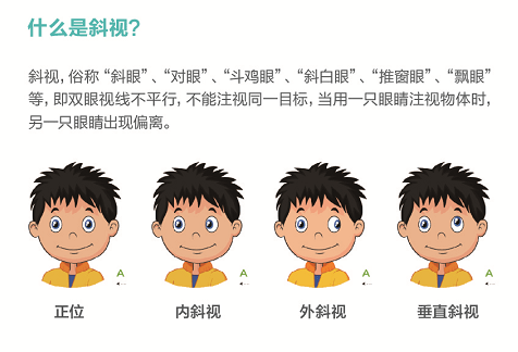 驾照最新政策下斜视者的驾驶权益保障及应对策略探讨